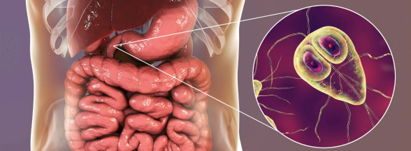 imagini gastrointestinale și colonice